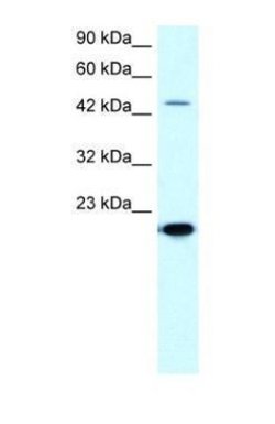 MMP19 Polyclonal Antibody, Invitrogen 100 &mu;g; Unconjugated:Antibodies,