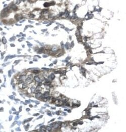 Prohibitin Polyclonal Antibody, Invitrogen 50 &mu;g | Buy Online | Thermo Scientific | Fisher Scientific