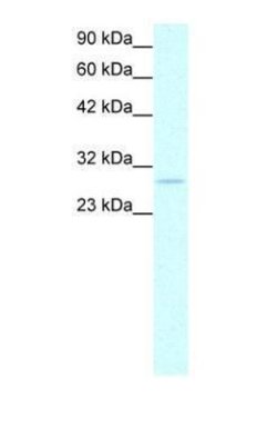 Prohibitin Polyclonal Antibody, Invitrogen 50 &mu;g | Buy Online | Thermo Scientific | Fisher Scientific