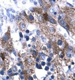 NFYA Polyclonal Antibody, Invitrogen 100 &mu;g | Buy Online | Thermo Scientific | Fisher Scientific