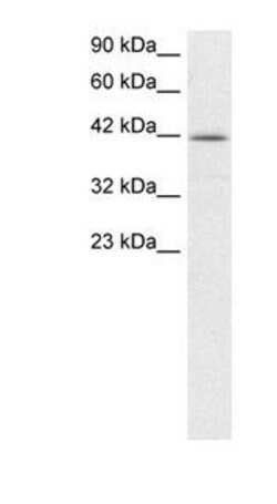 NFYA Polyclonal Antibody, Invitrogen 100 &mu;g | Buy Online | Thermo Scientific | Fisher Scientific