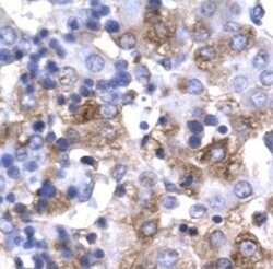 PIT1 Polyclonal Antibody, Invitrogen 50 &mu;g | Buy Online | Invitrogen | Fisher Scientific