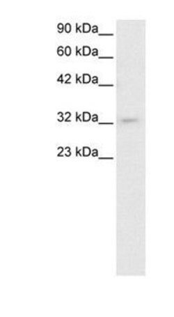 PIT1 Polyclonal Antibody, Invitrogen 50 &mu;g | Buy Online | Invitrogen | Fisher Scientific