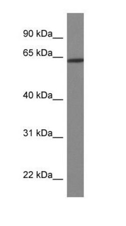 HOXD3, Polyclonal, Invitrogen 50 &mu;g | Buy Online | Thermo Scientific | Fisher Scientific