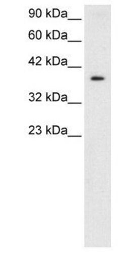 NT5C3A Polyclonal Antibody, Invitrogen 50 &mu;g | Buy Online | Thermo Scientific | Fisher Scientific