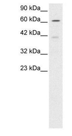 SNW1 Polyclonal Antibody, Invitrogen 50 &mu;g | Buy Online | Thermo Scientific | Fisher Scientific