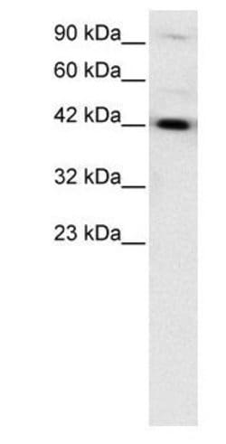 TCF2 Polyclonal Antibody, Invitrogen 50 &mu;g | Buy Online | Invitrogen | Fisher Scientific