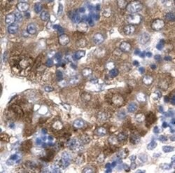 MOX1 Polyclonal Antibody, Invitrogen 50 &mu;g | Buy Online | Thermo Scientific | Fisher Scientific