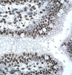 IRF8 Polyclonal Antibody, Invitrogen 50 &mu;g; Unconjugated:Antibodies,