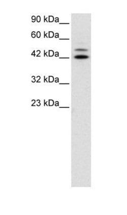 IRF8 Polyclonal Antibody, Invitrogen 50 &mu;g; Unconjugated:Antibodies,