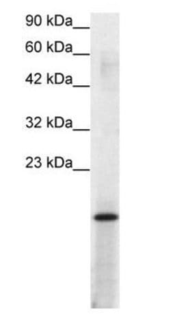 PC4 Polyclonal Antibody, Invitrogen 100 &mu;g | Buy Online | Invitrogen | Fisher Scientific