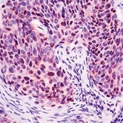 p14ARF Rabbit anti-Human, Polyclonal, Invitrogen 7 mL | Buy Online | Thermo Scientific | Fisher Scientific