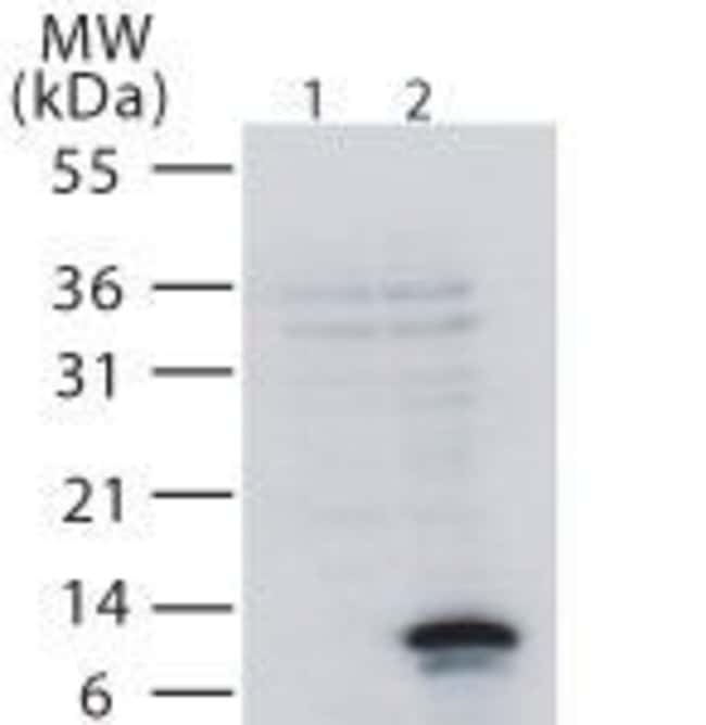 CD266 Rabbit anti-Human, Polyclonal, Invitrogen 200 μL; Unconjugated ...
