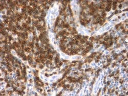 CD3e, Polyclonal, Invitrogen 1 mL | Buy Online | Thermo Scientific | Fisher Scientific