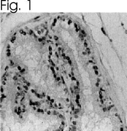 Invitrogen Estrogen Receptor alpha Polyclonal Antibody 50 &mu;g; Unconjugated:Antibodies,