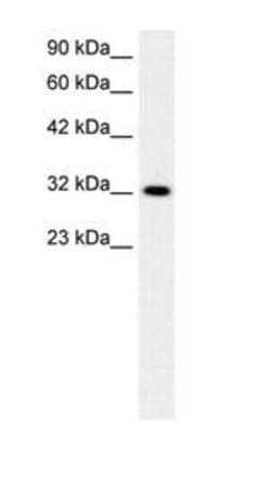 E2F5 Polyclonal Antibody, Invitrogen 50 &mu;g; Unconjugated:Antibodies,