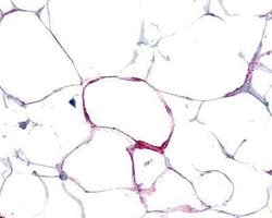 VIPR1, Polyclonal, Invitrogen 25 &mu;g | Buy Online | Thermo Scientific | Fisher Scientific