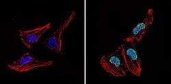 Invitrogen LXR alpha Polyclonal Antibody 200 &mu;g; Unconjugated:Antibodies,