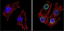 Invitrogen LXR beta Polyclonal Antibody 100 &mu;g; Unconjugated:Antibodies,
