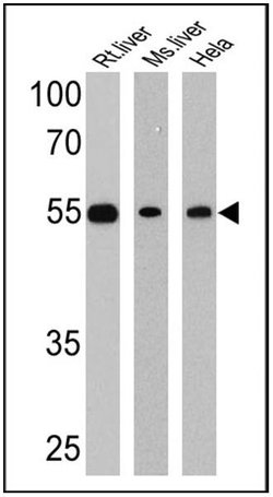 Invitrogen LXR beta Polyclonal Antibody 100 &mu;g; Unconjugated:Antibodies,