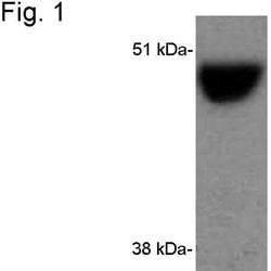 Invitrogen CYP2A6 Polyclonal Antibody 100 &mu;L; Unconjugated:Antibodies,