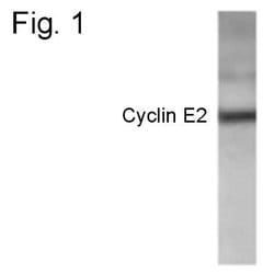 Invitrogen Cyclin E2 Polyclonal Antibody 100 &mu;g | Buy Online | Invitrogen&trade; | Fisher Scientific