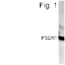 Invitrogen RDH11 Polyclonal Antibody 100 &mu;L; Unconjugated:Antibodies,