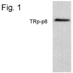 Invitrogen TRPM8 Polyclonal Antibody 100 &mu;g; Unconjugated:Antibodies,