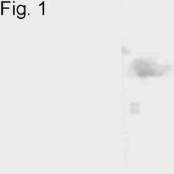 Nurr1 Polyclonal Antibody, Invitrogen 100 &mu;g; Unconjugated:Antibodies,