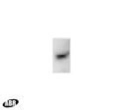 Invitrogen Parkin Polyclonal Antibody 100 &mu;g | Buy Online | Invitrogen&trade; | Fisher Scientific