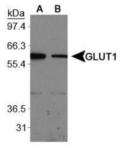 GLUT1 Polyclonal Antibody, Invitrogen 100 &mu;L; Unconjugated:Antibodies,