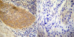 Invitrogen Glucocorticoid Receptor Polyclonal Antibody 50 &mu;g; Unconjugated:Antibodies,