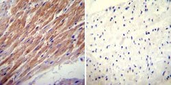Invitrogen Glucocorticoid Receptor alpha Polyclonal Antibody 50 &mu;g;