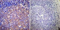 Invitrogen Glucocorticoid Receptor alpha Polyclonal Antibody 50 &mu;g;