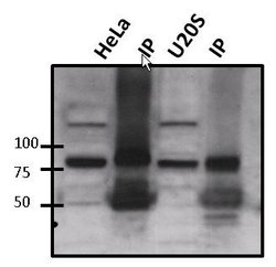 ATRIP Polyclonal Antibody, Invitrogen&trade; 100 &mu;g; Unconjugated 