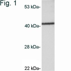 Invitrogen CaMKI Polyclonal Antibody 100 &mu;g; Unconjugated:Antibodies,