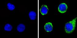 Invitrogen Angiostatin Polyclonal Antibody 100 &mu;g; Unconjugated:Antibodies,