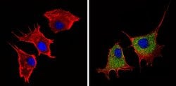 Invitrogen Angiostatin Polyclonal Antibody 100 &mu;g; Unconjugated:Antibodies,