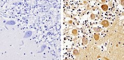 Invitrogen™ beta-Arrestin 1,2 Polyclonal Antibody