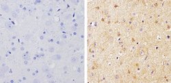 Invitrogen beta-Arrestin 1,2 Polyclonal Antibody 200 &mu;g; Unconjugated:Antibodies,