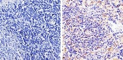Invitrogen beta-Arrestin 1,2 Polyclonal Antibody 200 &mu;g; Unconjugated:Antibodies,