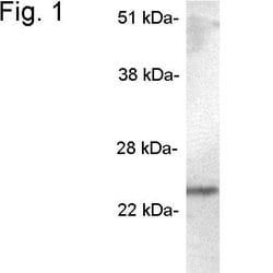 Invitrogen SCAMP5 Polyclonal Antibody 100 &mu;g; Unconjugated:Antibodies,