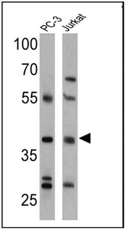 Invitrogen CNR2 Polyclonal Antibody 100 &mu;L; Unconjugated:Antibodies,
