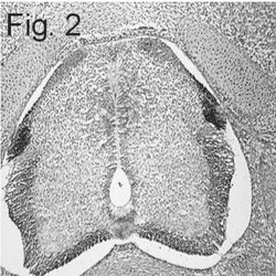 Cannabinoid Receptor 1 Polyclonal Antibody, Invitrogen 100 &mu;L; Unconjugated:Antibodies,