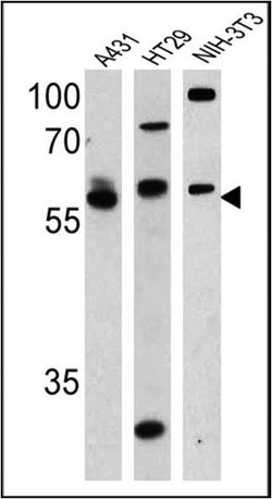 Cannabinoid Receptor 1 Polyclonal Antibody, Invitrogen 100 &mu;L; Unconjugated:Antibodies,