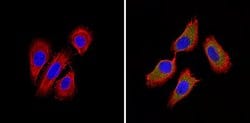 Invitrogen BACE2 Polyclonal Antibody 100 &mu;g; Unconjugated:Antibodies,
