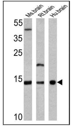 Invitrogen VAMP3 Polyclonal Antibody 100 &mu;g; Unconjugated:Antibodies,