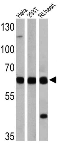 Invitrogen FOXO1 Polyclonal Antibody 100 &mu;g; Unconjugated:Antibodies,