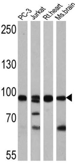 Invitrogen FOXO3A Polyclonal Antibody 100 &mu;g; Unconjugated:Antibodies,