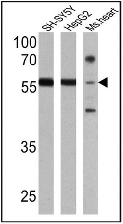 Invitrogen RARB Polyclonal Antibody 100 &mu;L; Unconjugated:Antibodies,
